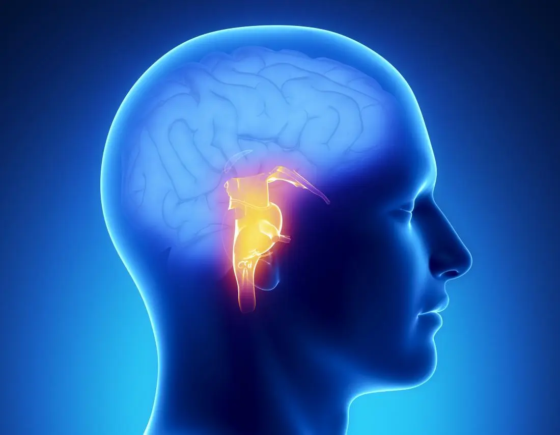 What Are The Signs Of A Brain Tumor If You Have Recurring Headaches?
