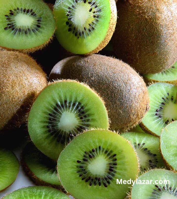 These Are The Top 10 Kiwis' Amazing Health Benefits